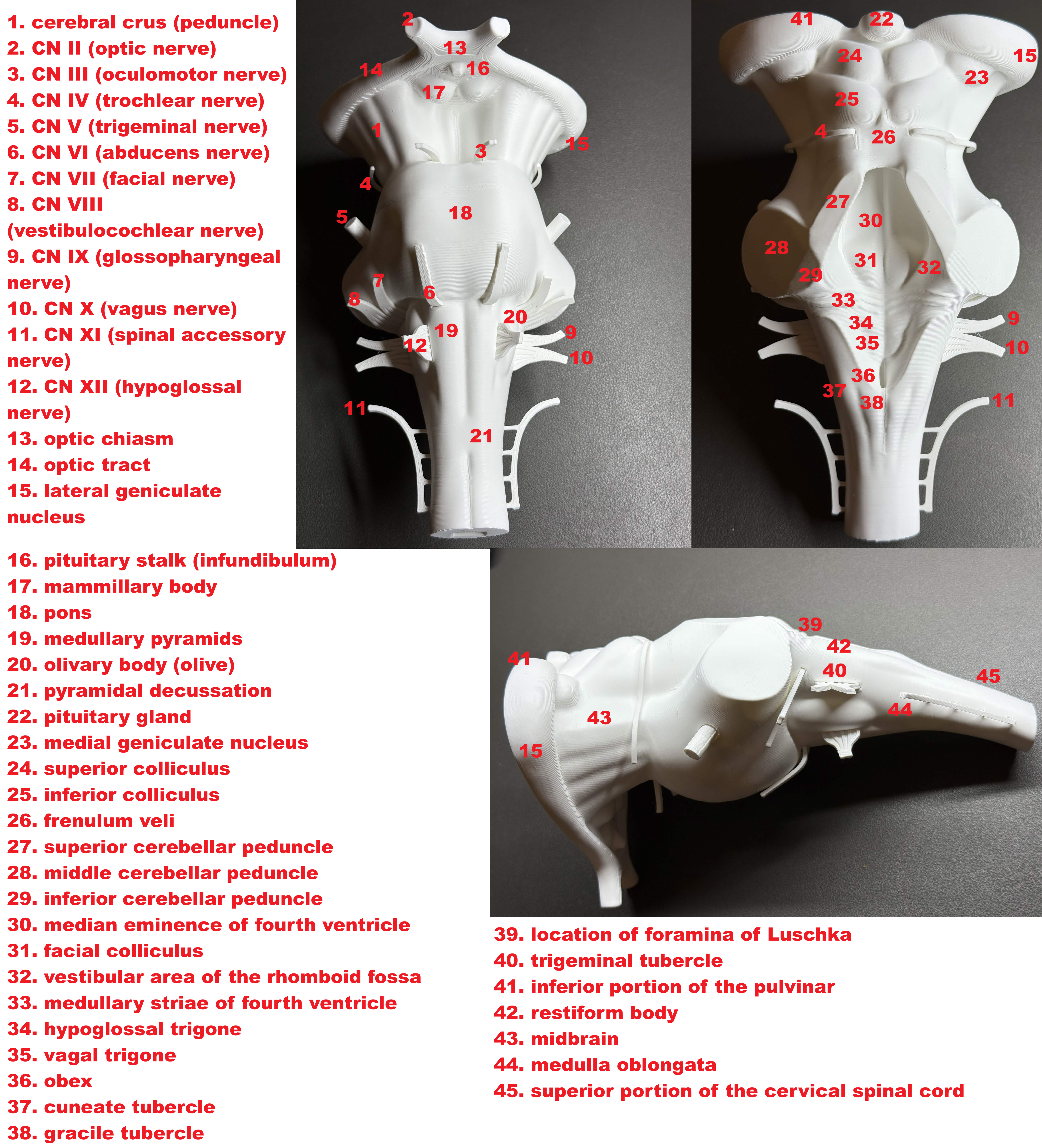 Brainstem Anatomy Model with Cranial Nerves