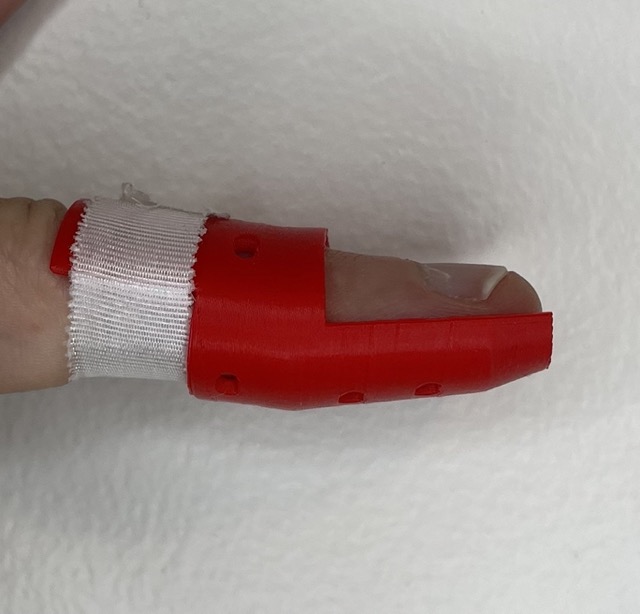 Finger Splint by GoblinTnilblog Download free STL model