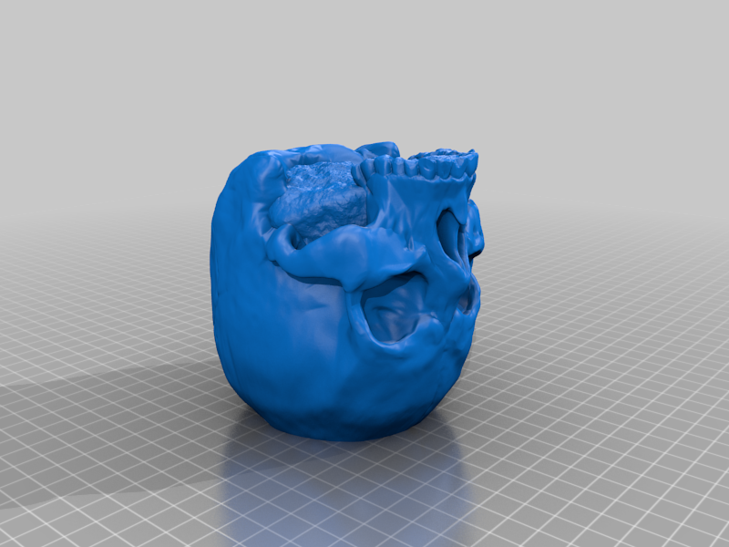 SodaSkull