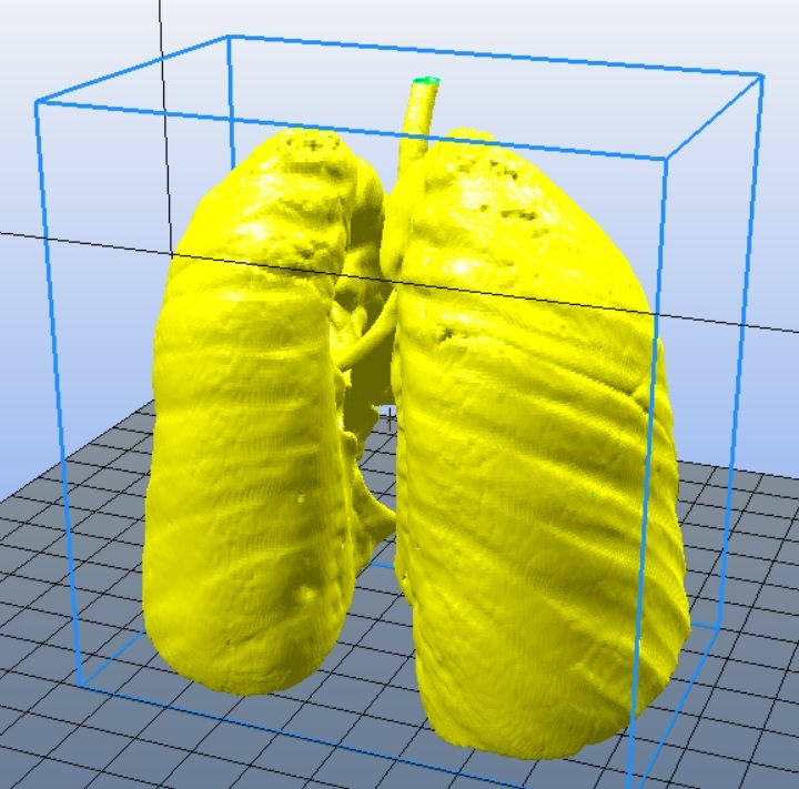 Miniatura 14 do modelo 3D Lungs 3D Model