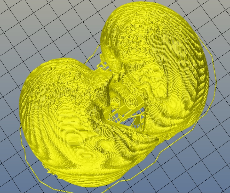 Miniatura 16 do modelo 3D Lungs 3D Model