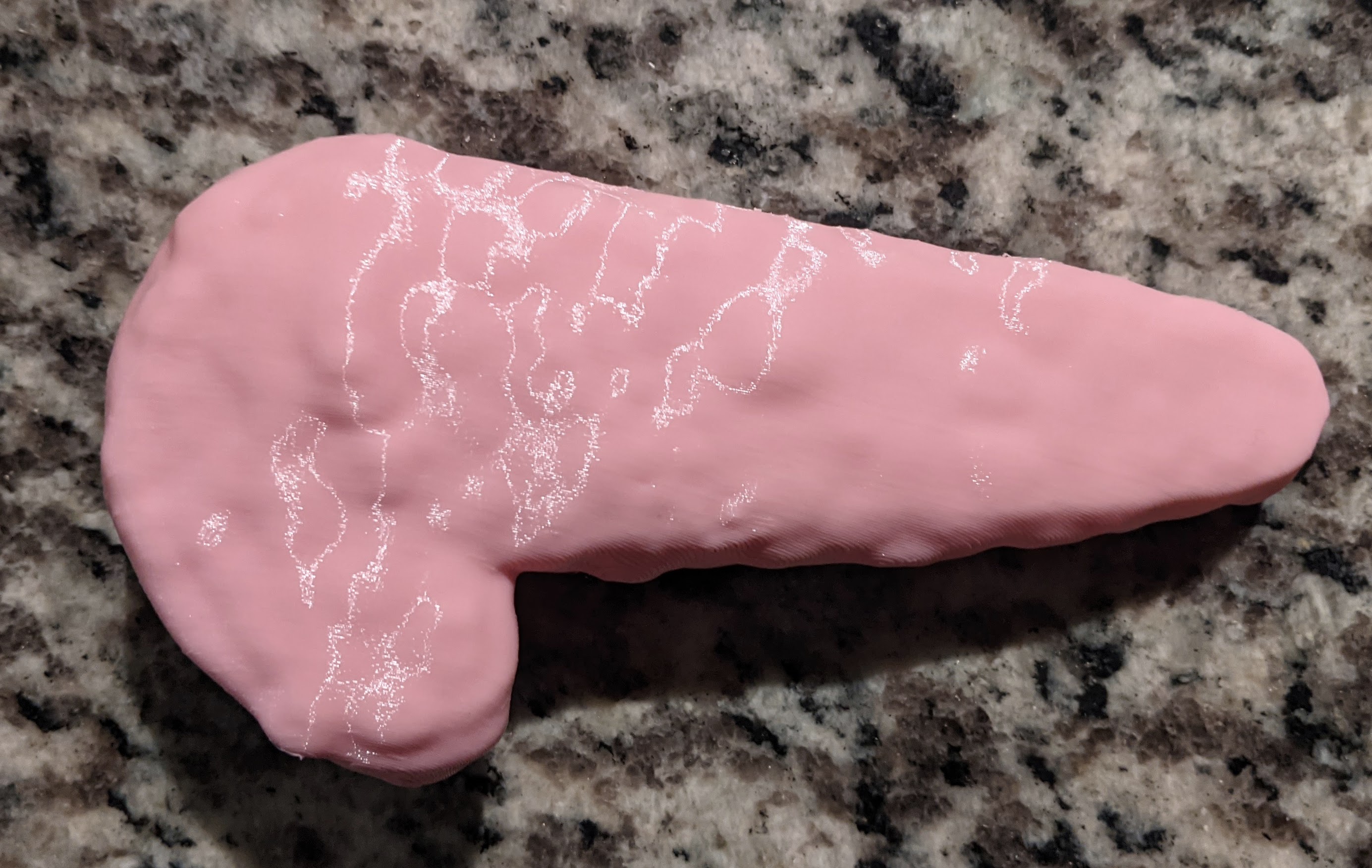 Pancreas v1
