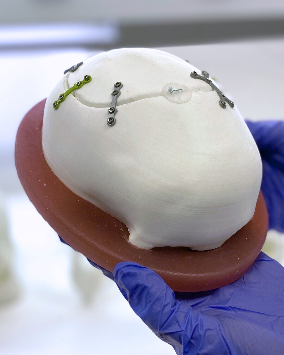 Cranioplasty Training Models (3 cranial defect scenarios)