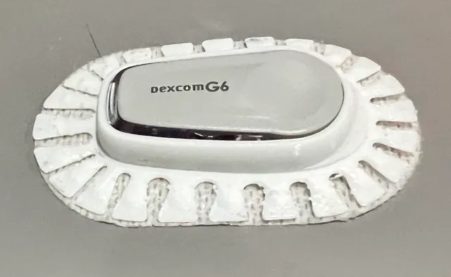 Dexcom G6 TPU cover Remix