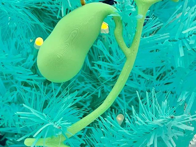 Commemorative Gallbladder