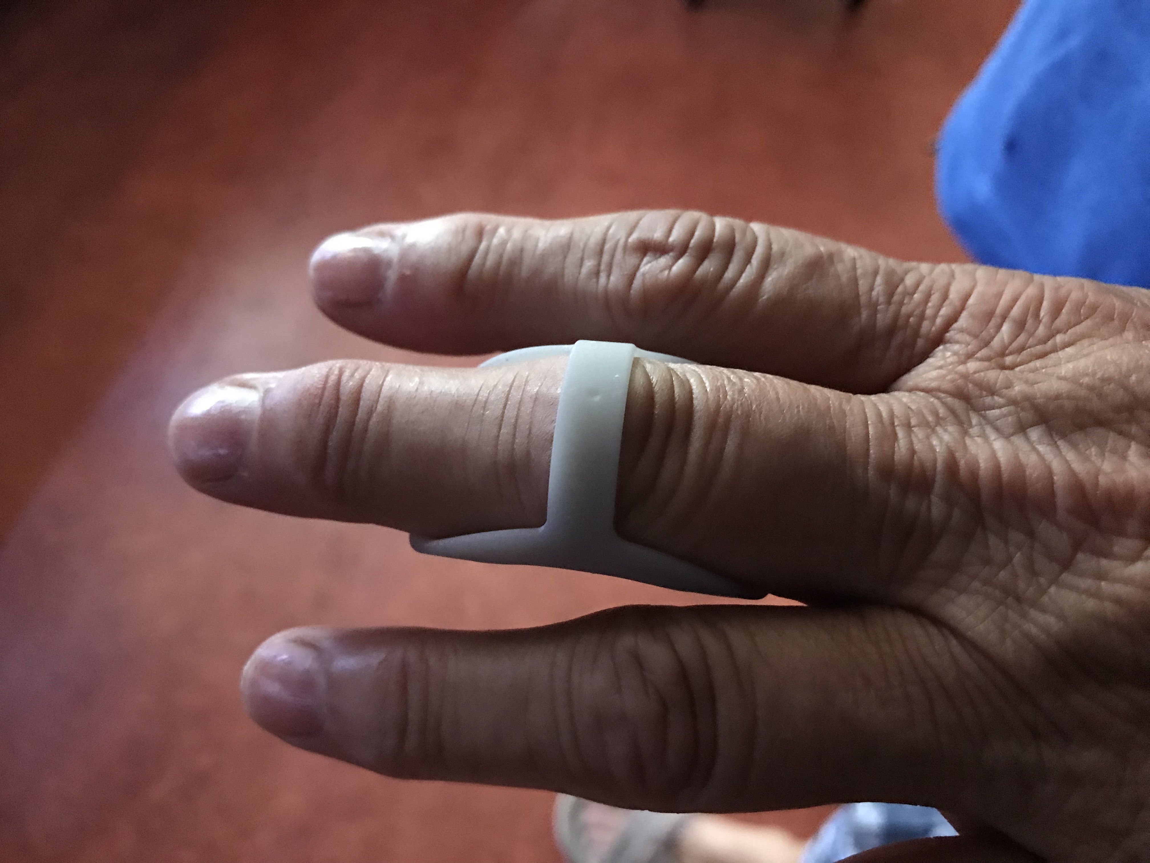 Splint for finger arthritis