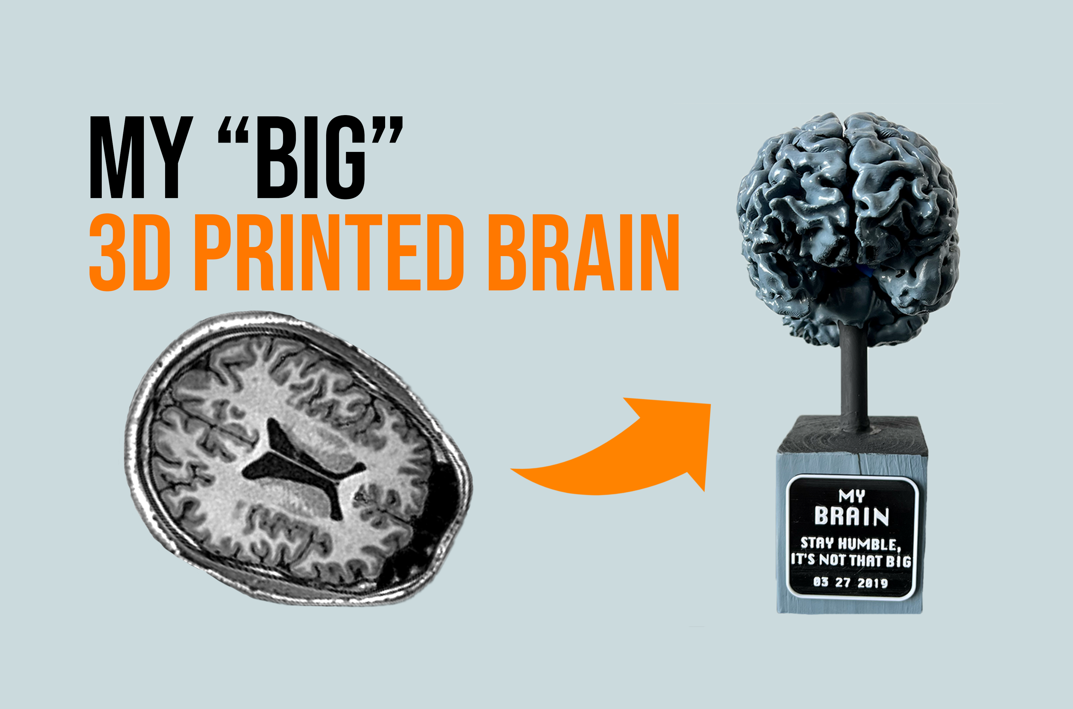 3D Printable Brain - From MRI