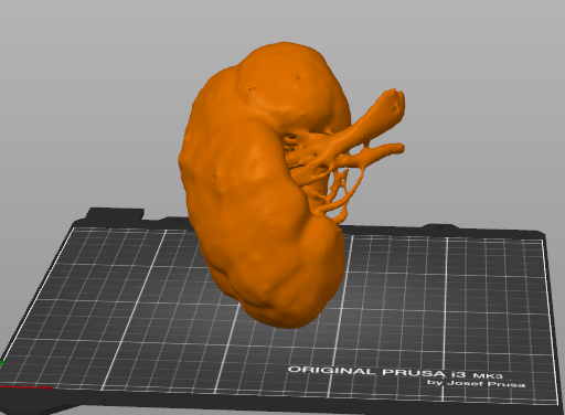 Human Kidney from CT Scan