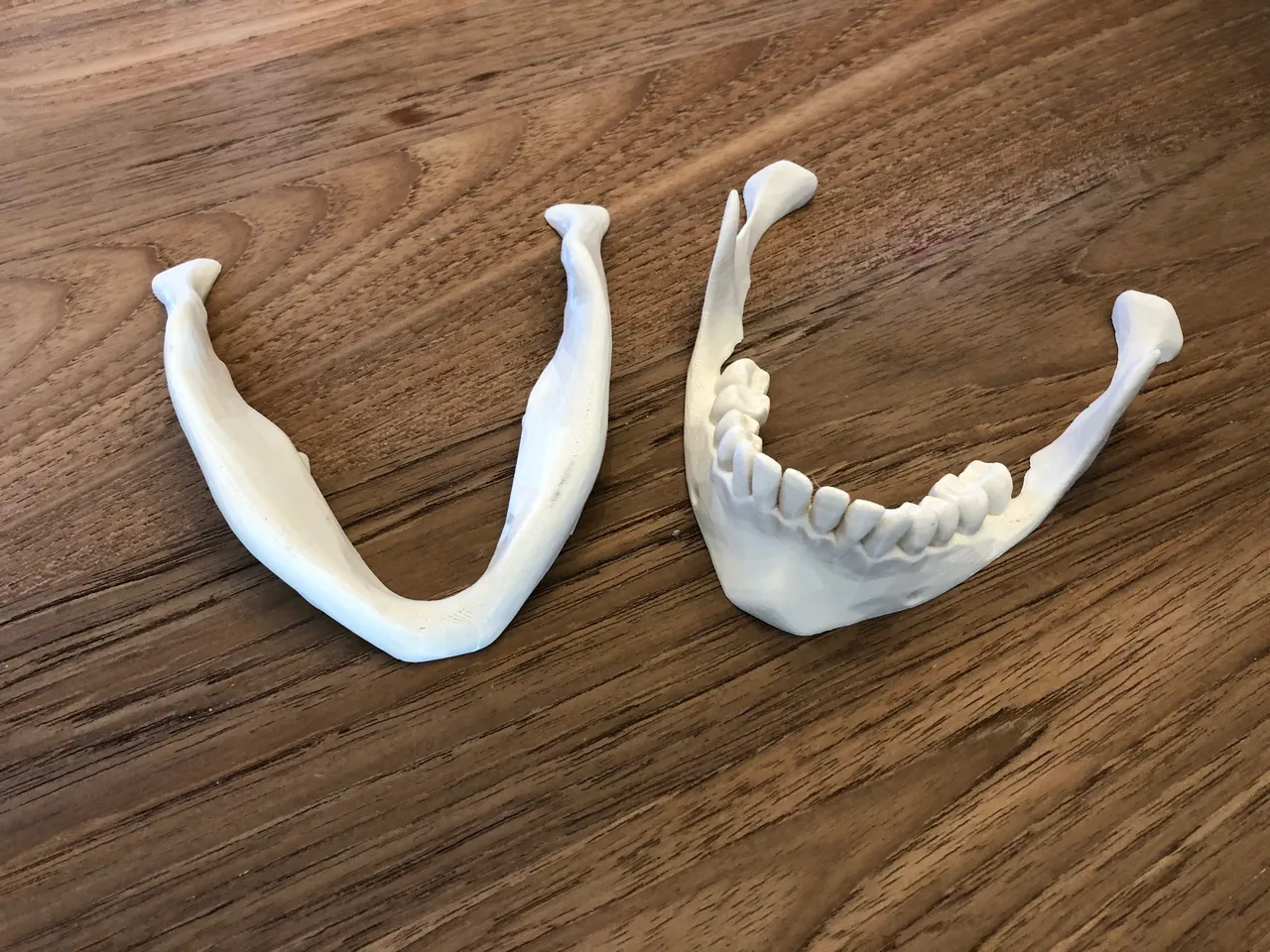 Human skull, anatomically correct and printer friendly **updated with jaw**  by dantana - Thingiverse