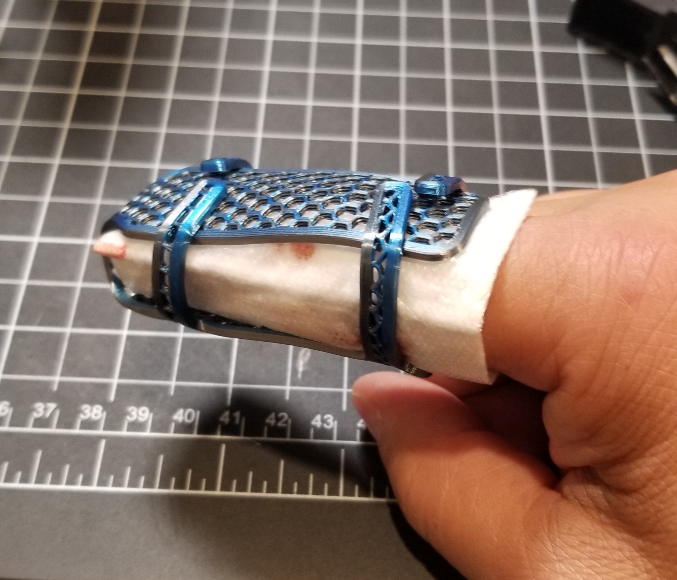 Finger Splint (with integrated straps)