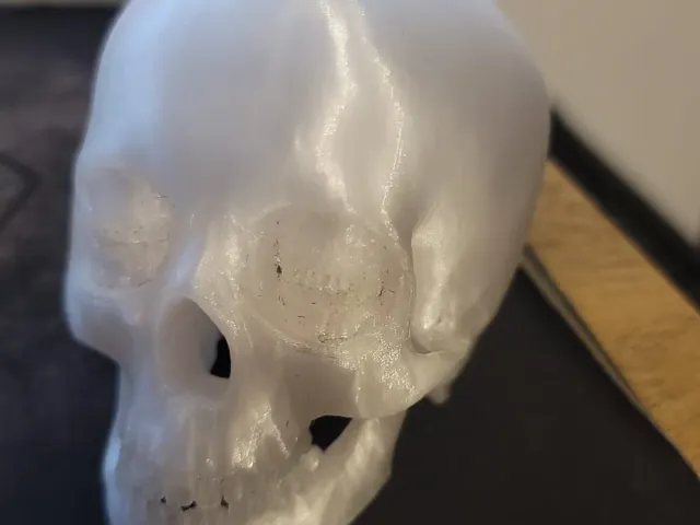 The Corinthian Skull