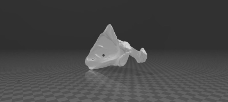 Scapula