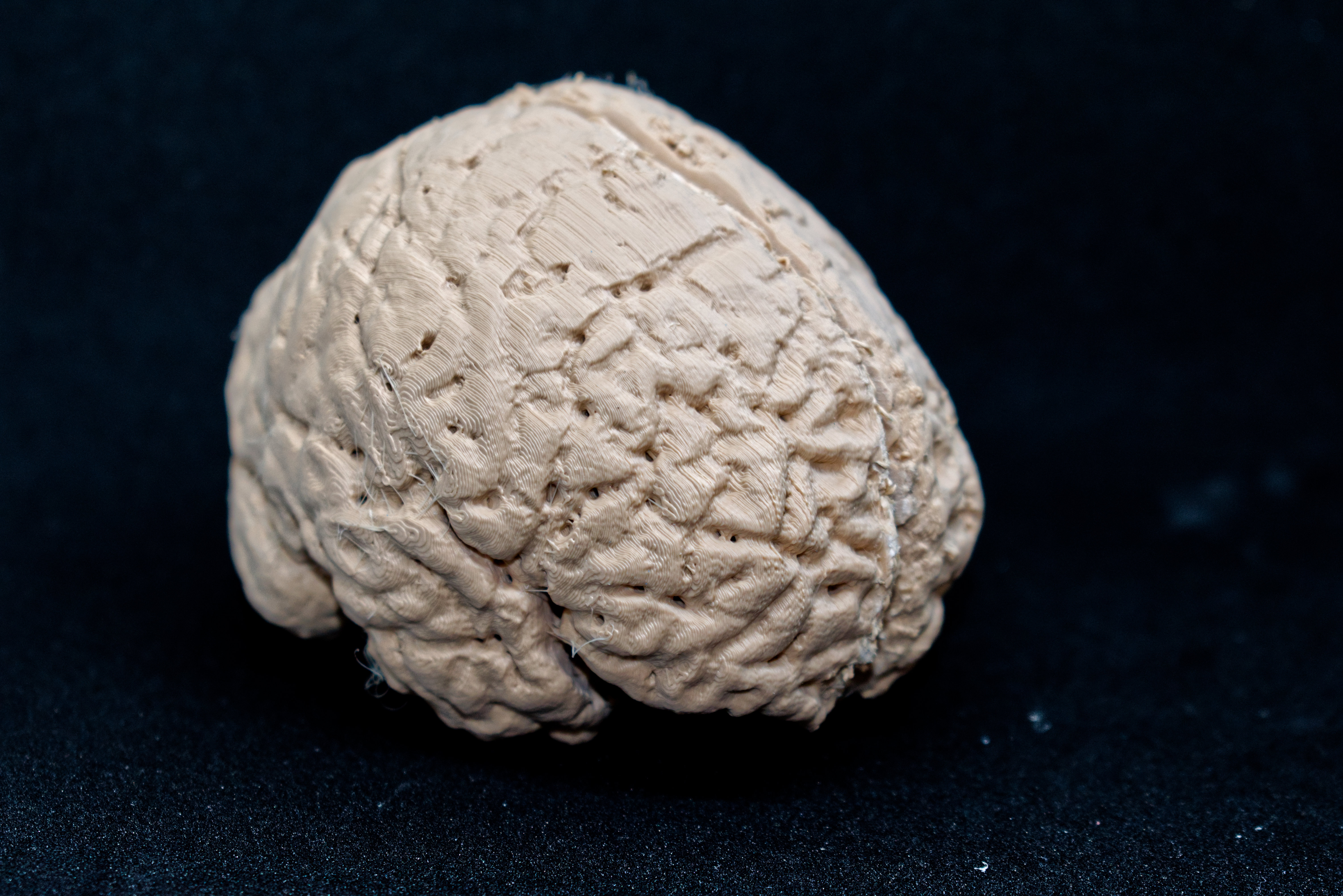 Human Brain Model from MRI Scan