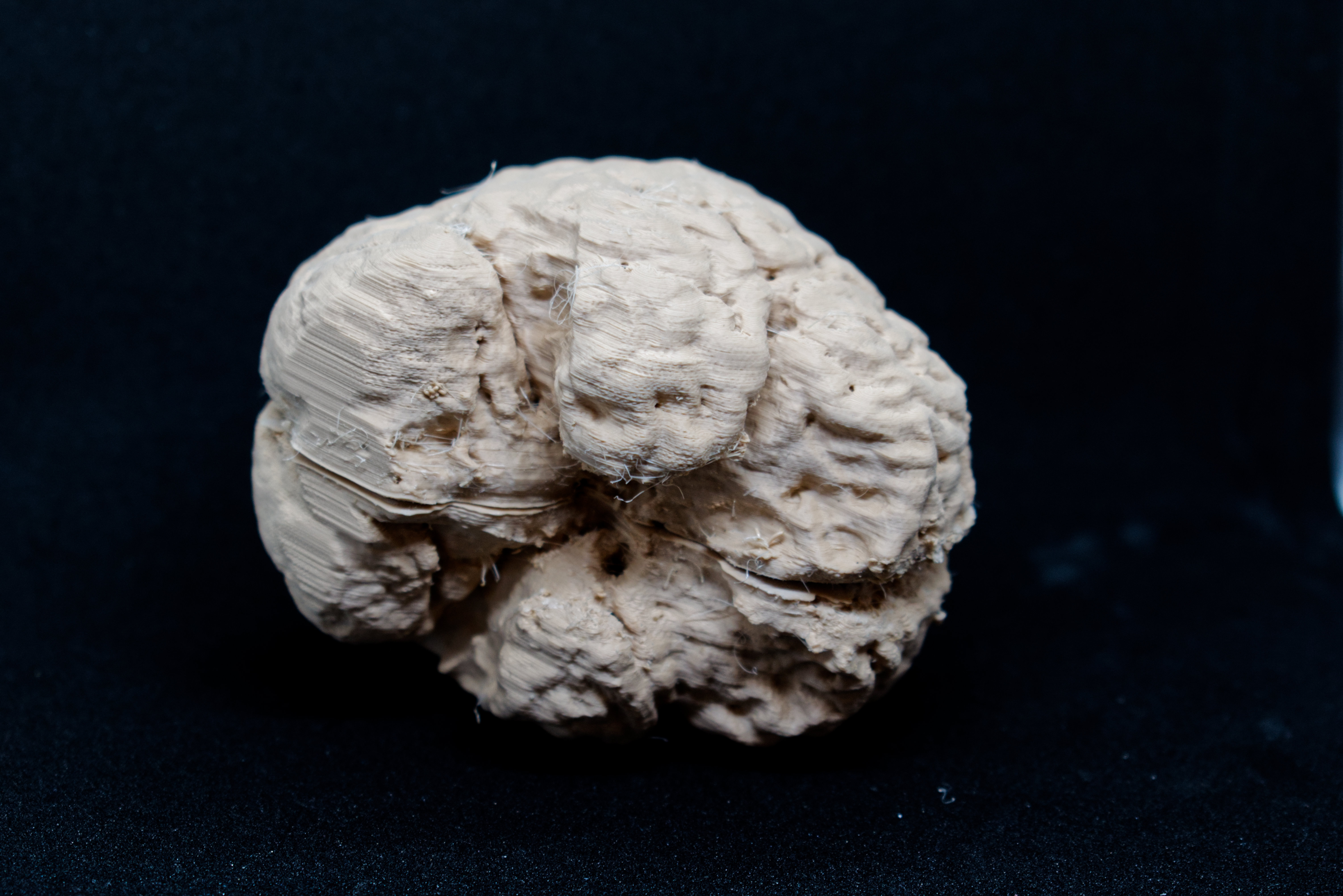 Miniatura 2 do modelo 3D Human Brain Model from MRI Scan