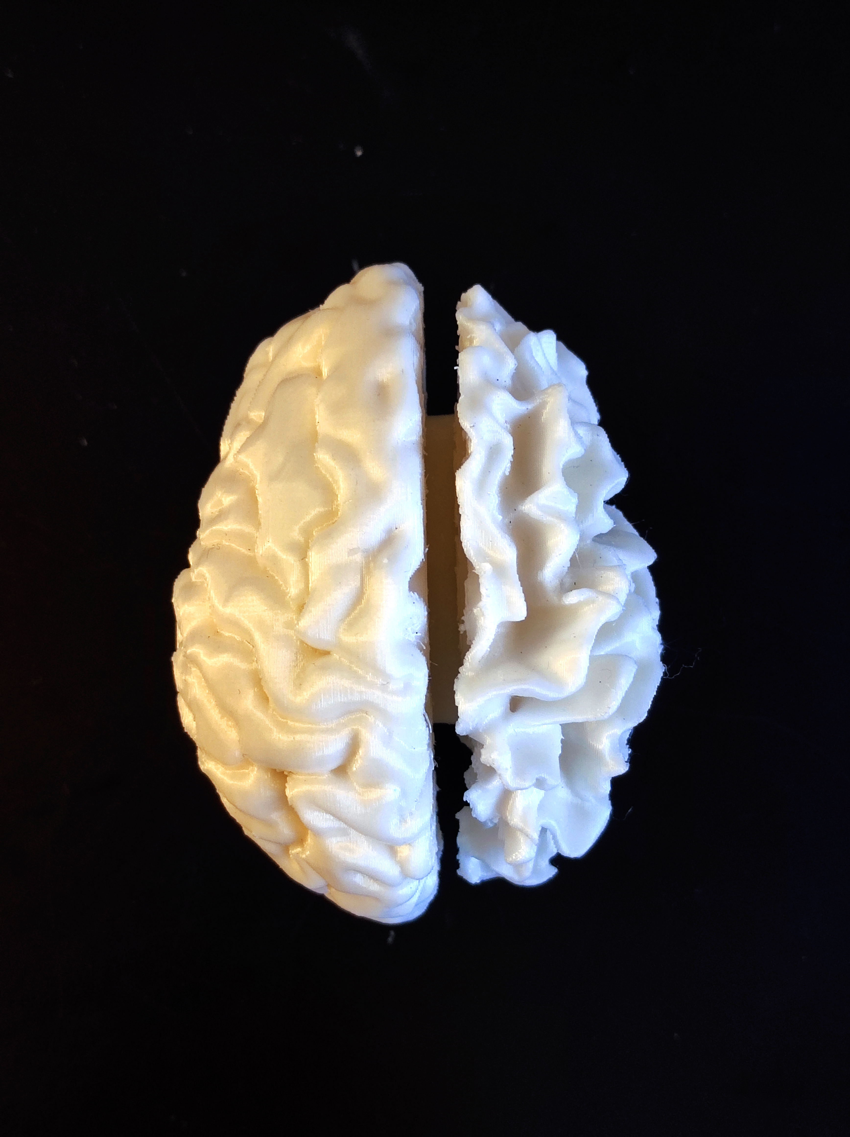 Brain with grey and white matter