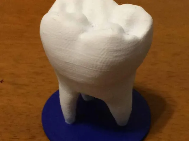 Odonto Tooth Decoration