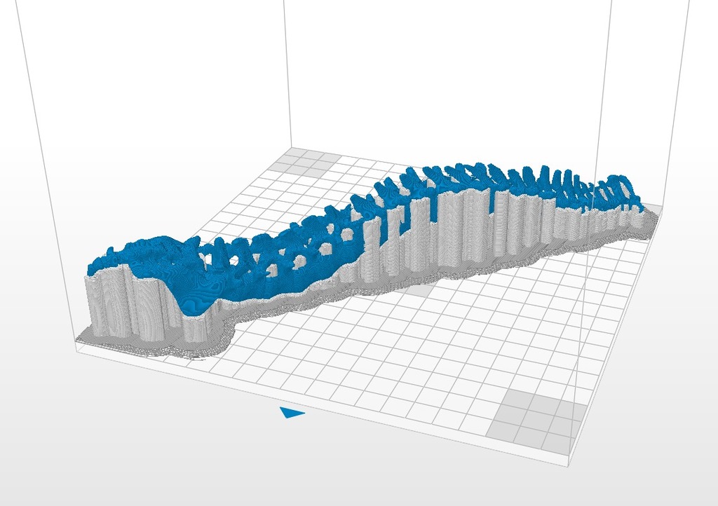 Human Spine with Exposure Stand by giufini | Download free STL model ...