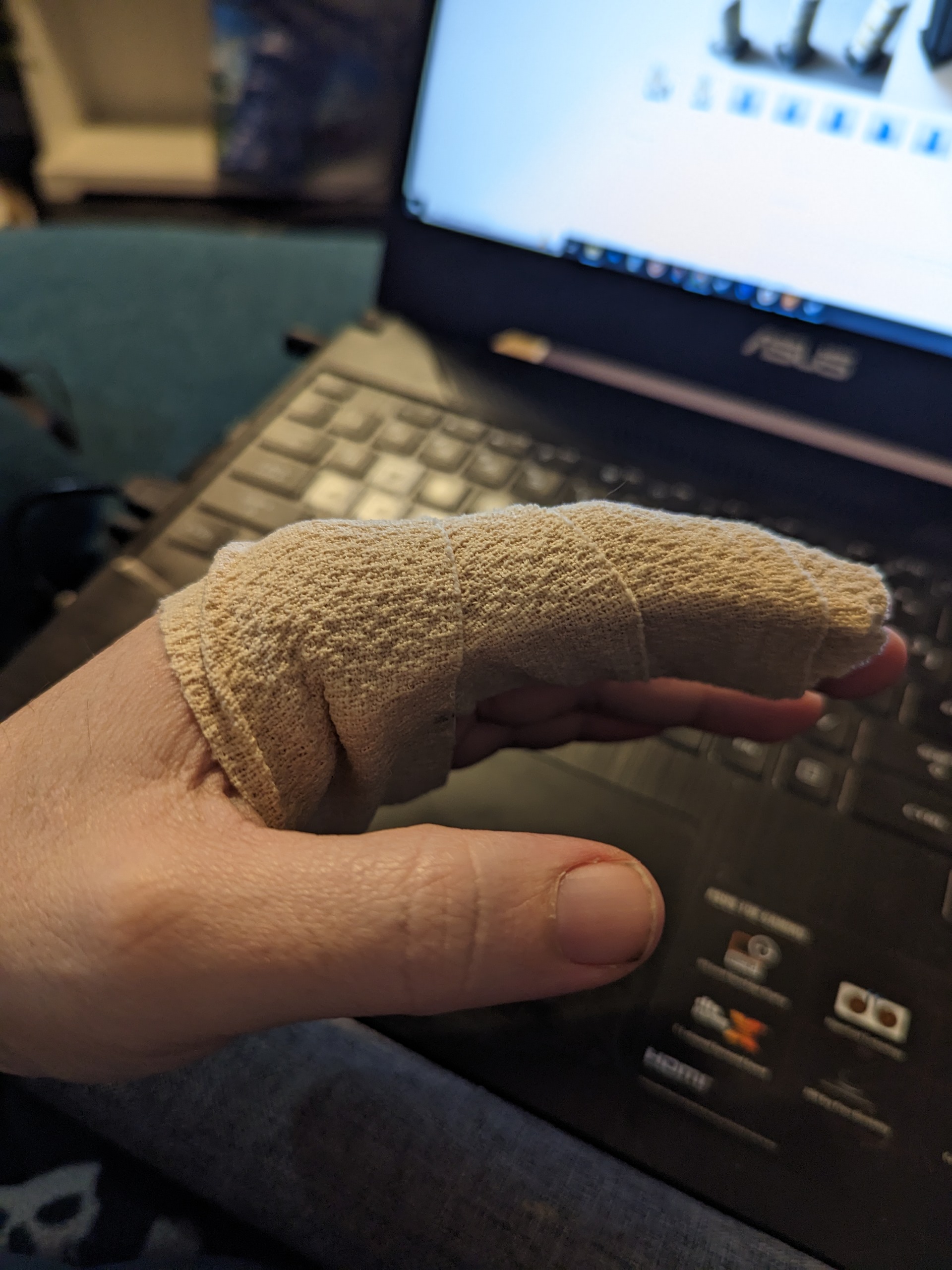 Simple TwoFinger Splint by ShopWizard Download free STL model