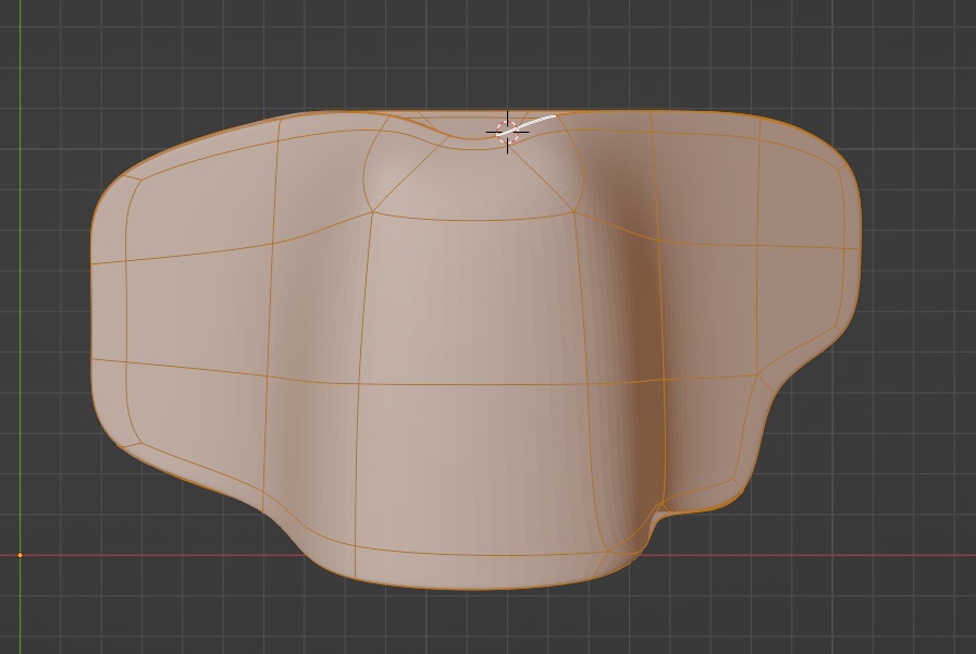 stoma shield by amistad Download free STL model