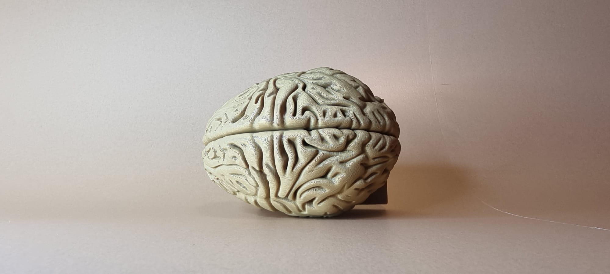 Brain — thumbnail 4