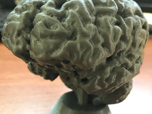 Brain