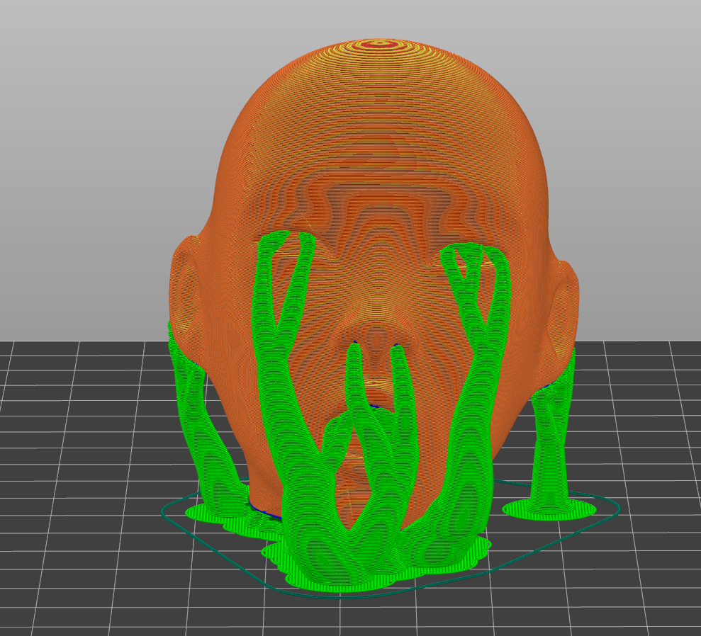 Infected head sculpture by Ajiata Download free STL model