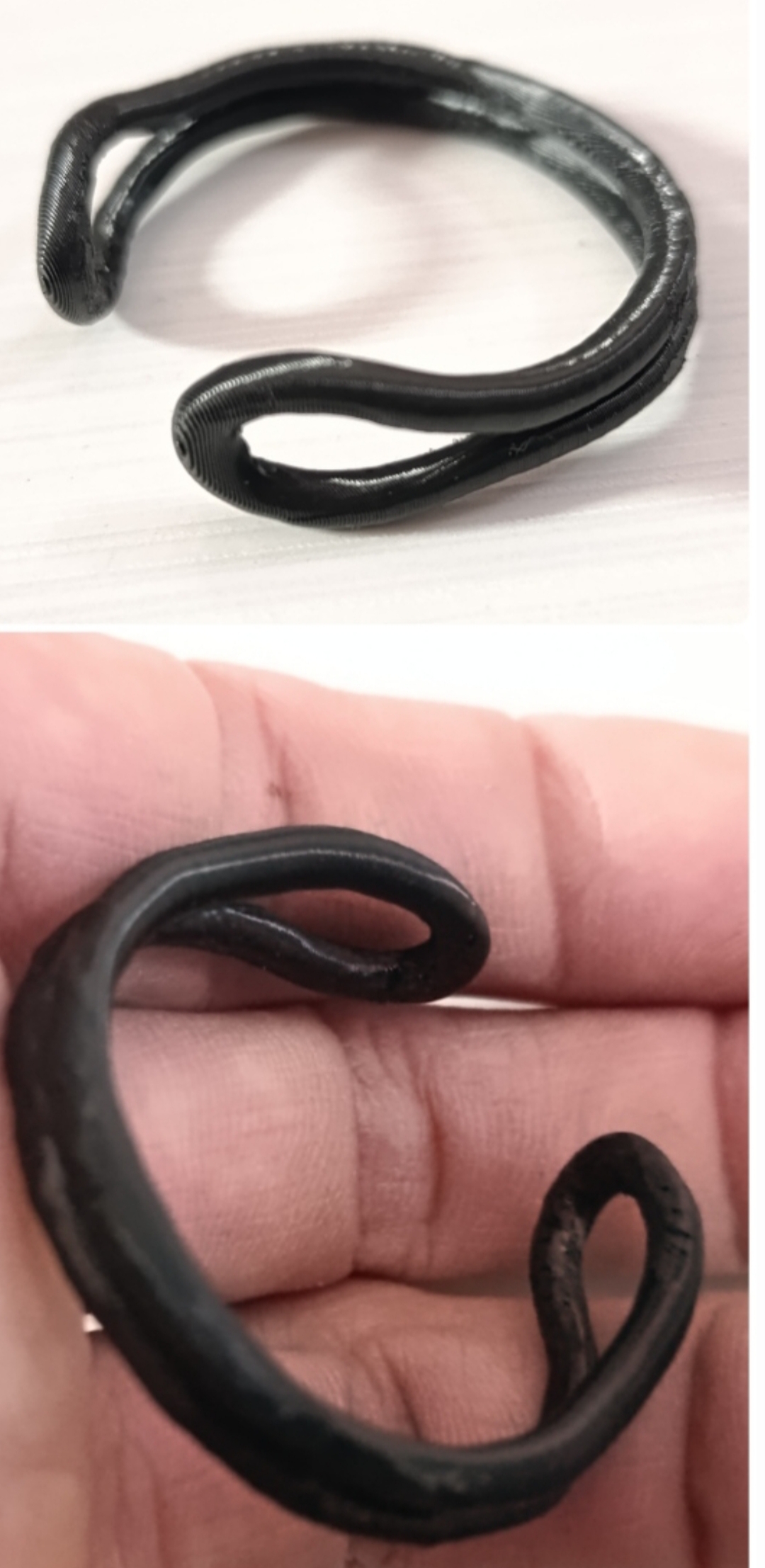 Foreskin retraction device "ring"