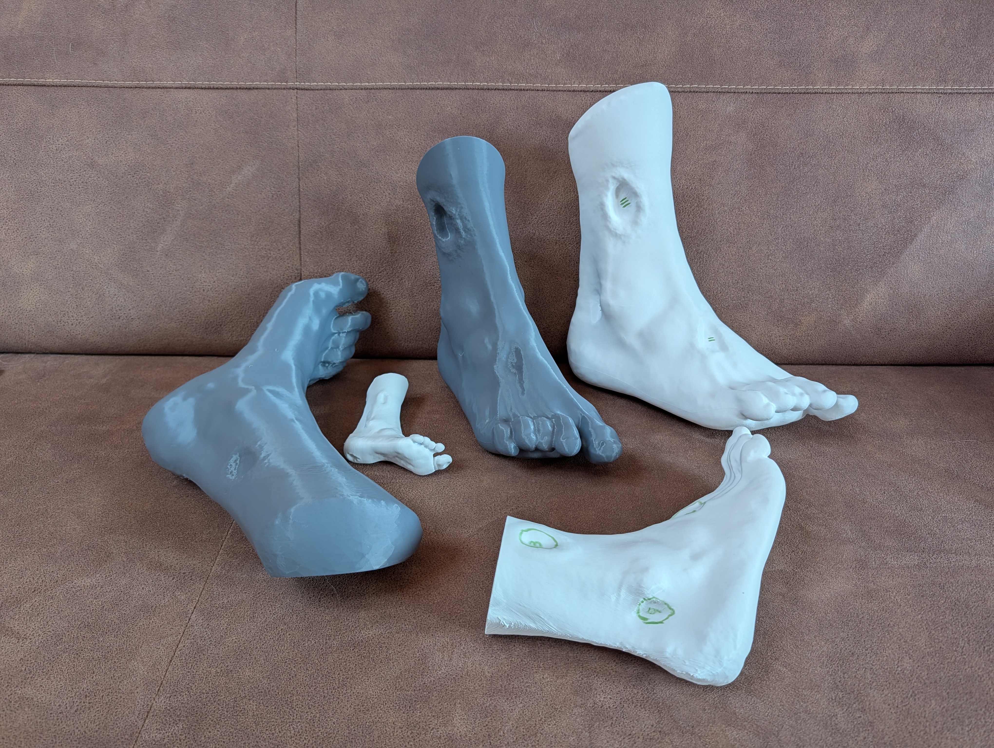 Diabetic Human Foot Model / Wound Training Phantom – Support-Free FDM Print