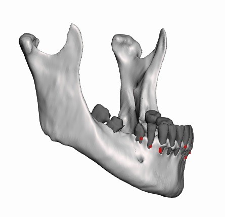human mandible with teeth — miniatura 2