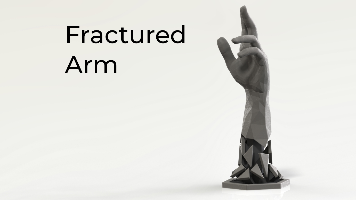 Fractured Arm
