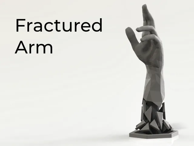 Fractured Arm