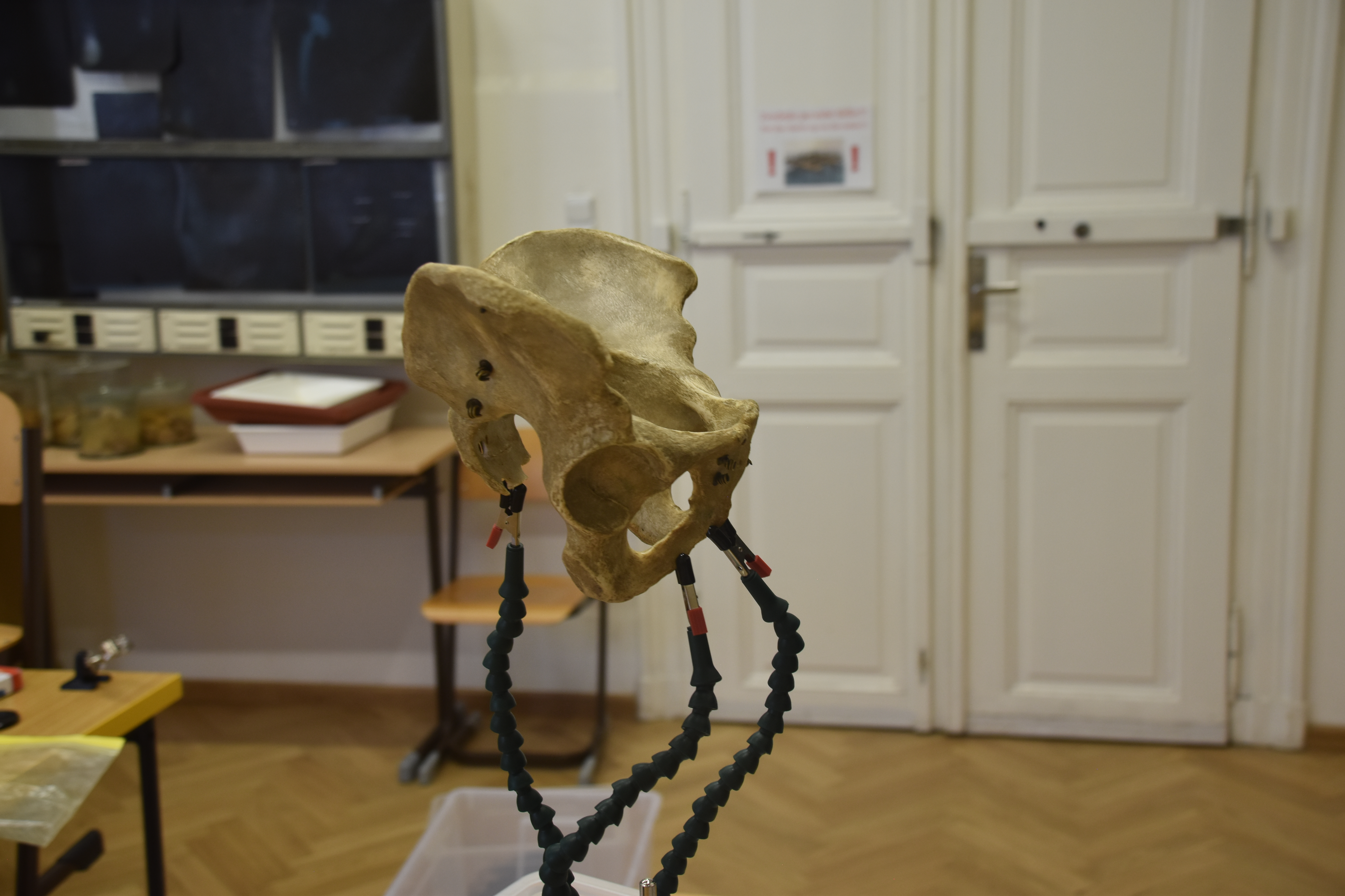 Pelvis Scan - Pelvis (M) — thumbnail 2