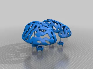 Brain Trellis