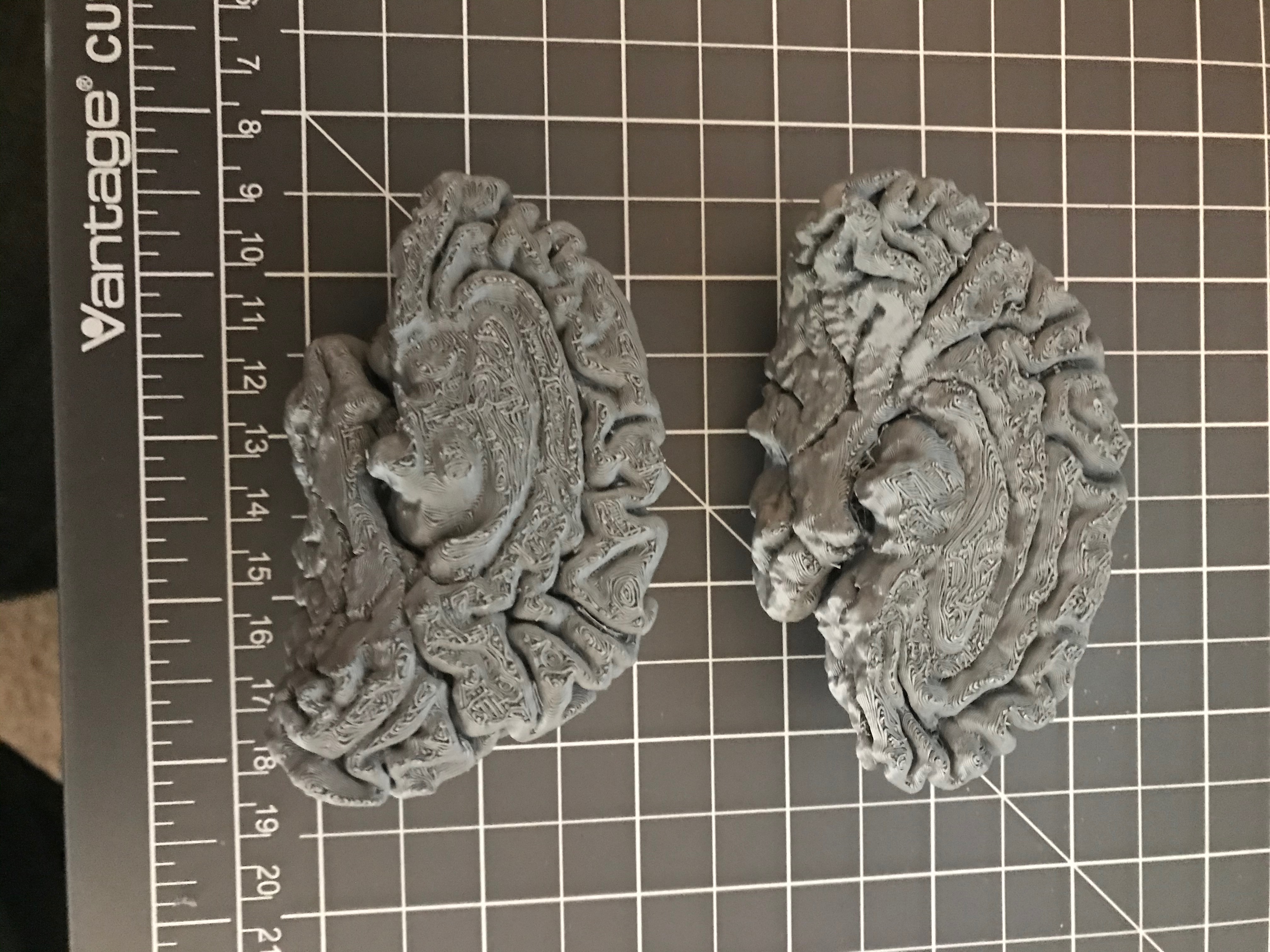Miniatura 3 do modelo 3D Human Brain Hemispheres from MRI data