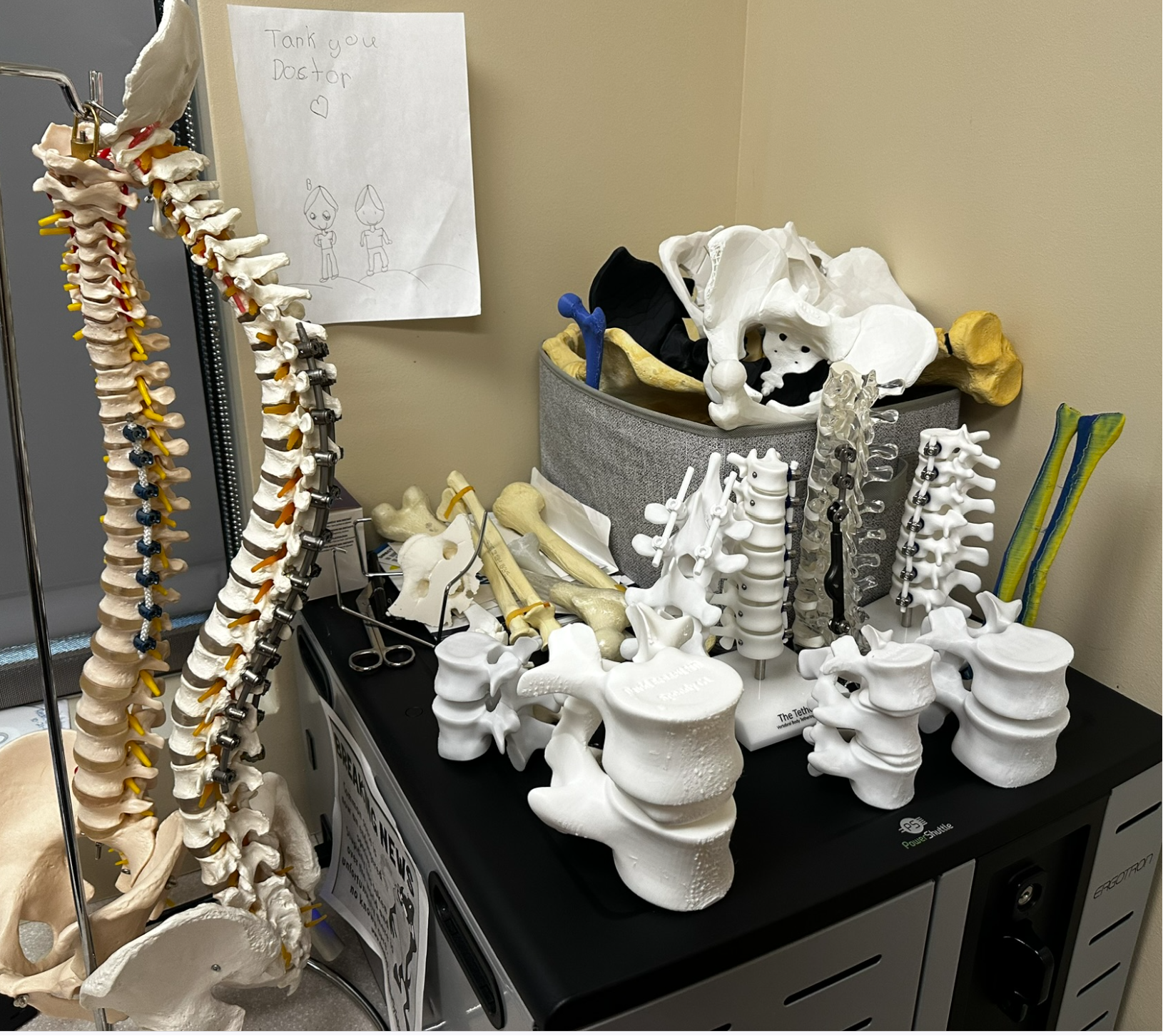 High grade spondylolisthesis model
