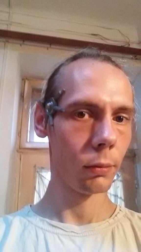 Borg implant