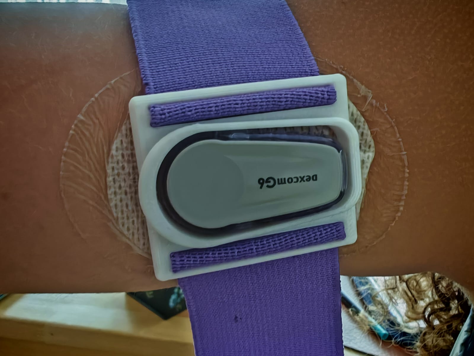 Dexcom G6 support/holder