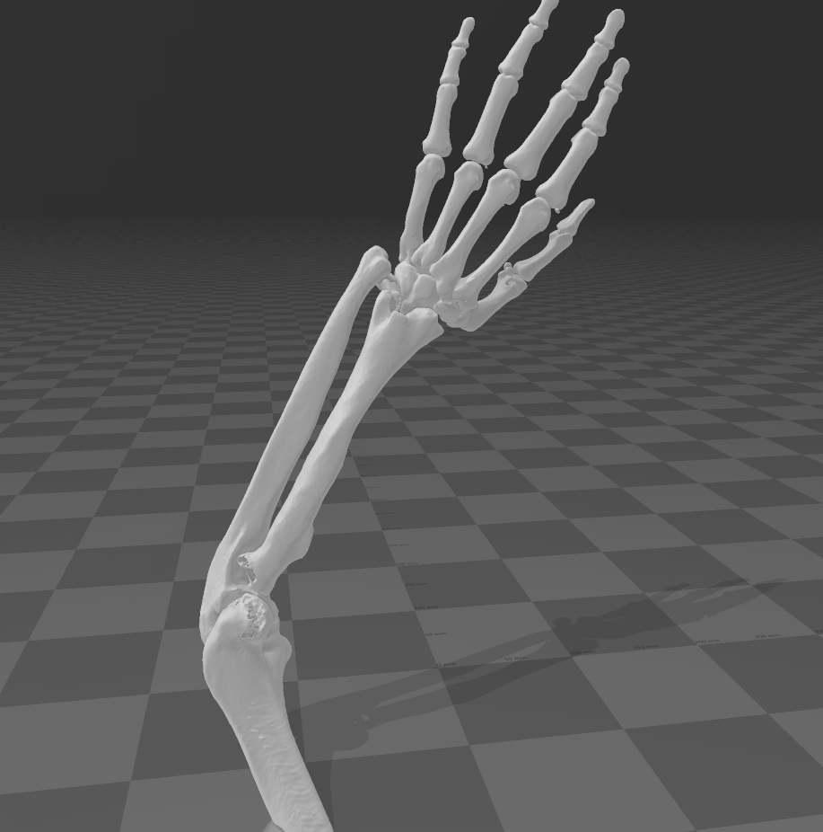 elbow joint