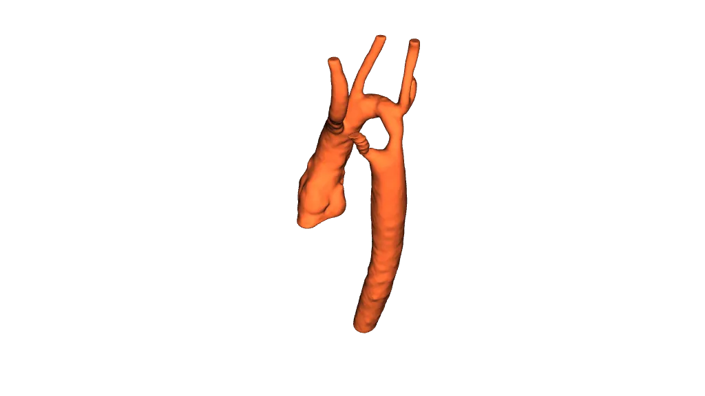 Aorta by Paweł Ozga | Download free STL model | Printables.com