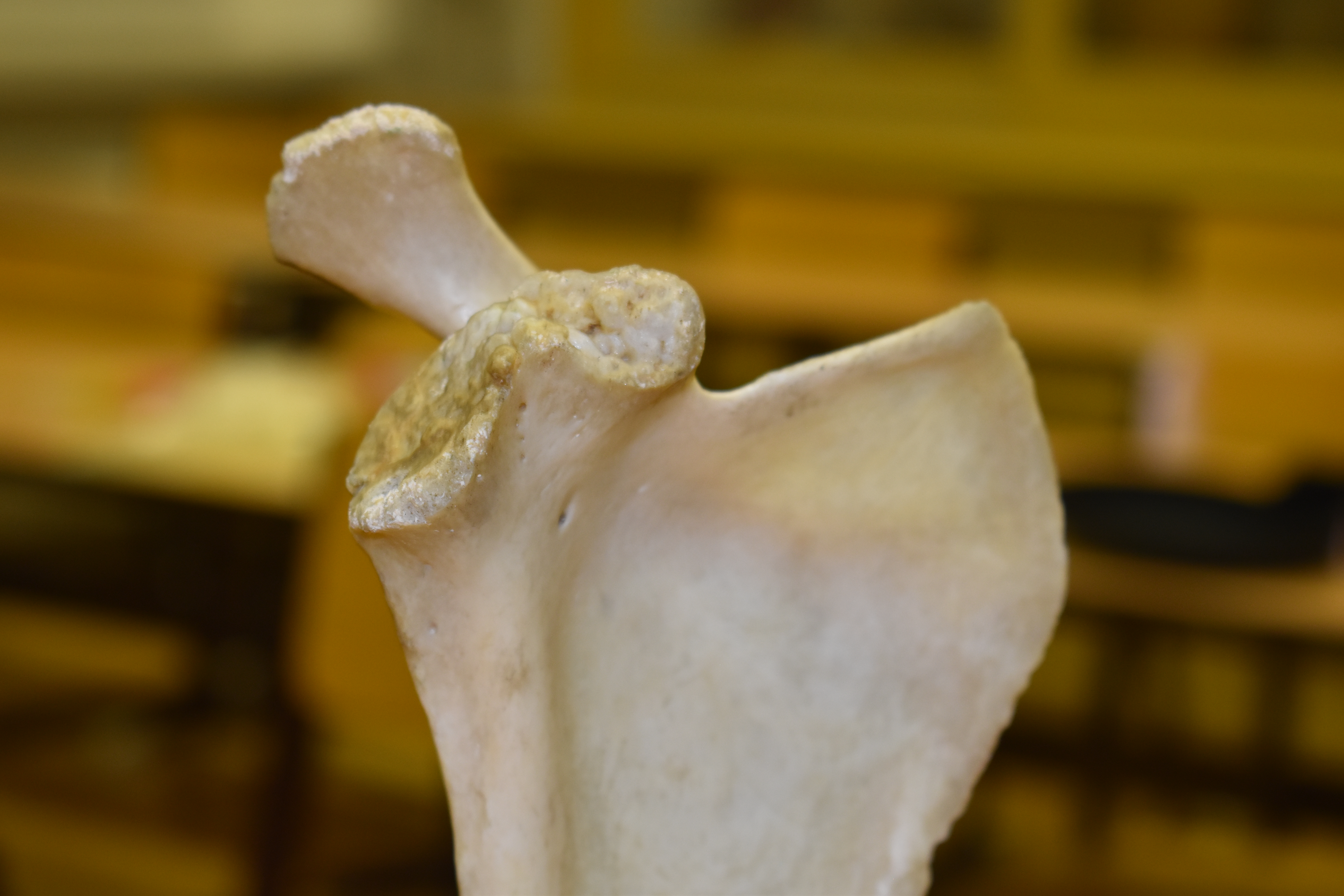 Shoulder Blade Scan - Scapula (R) - Missing Coracoid process — miniatura 2