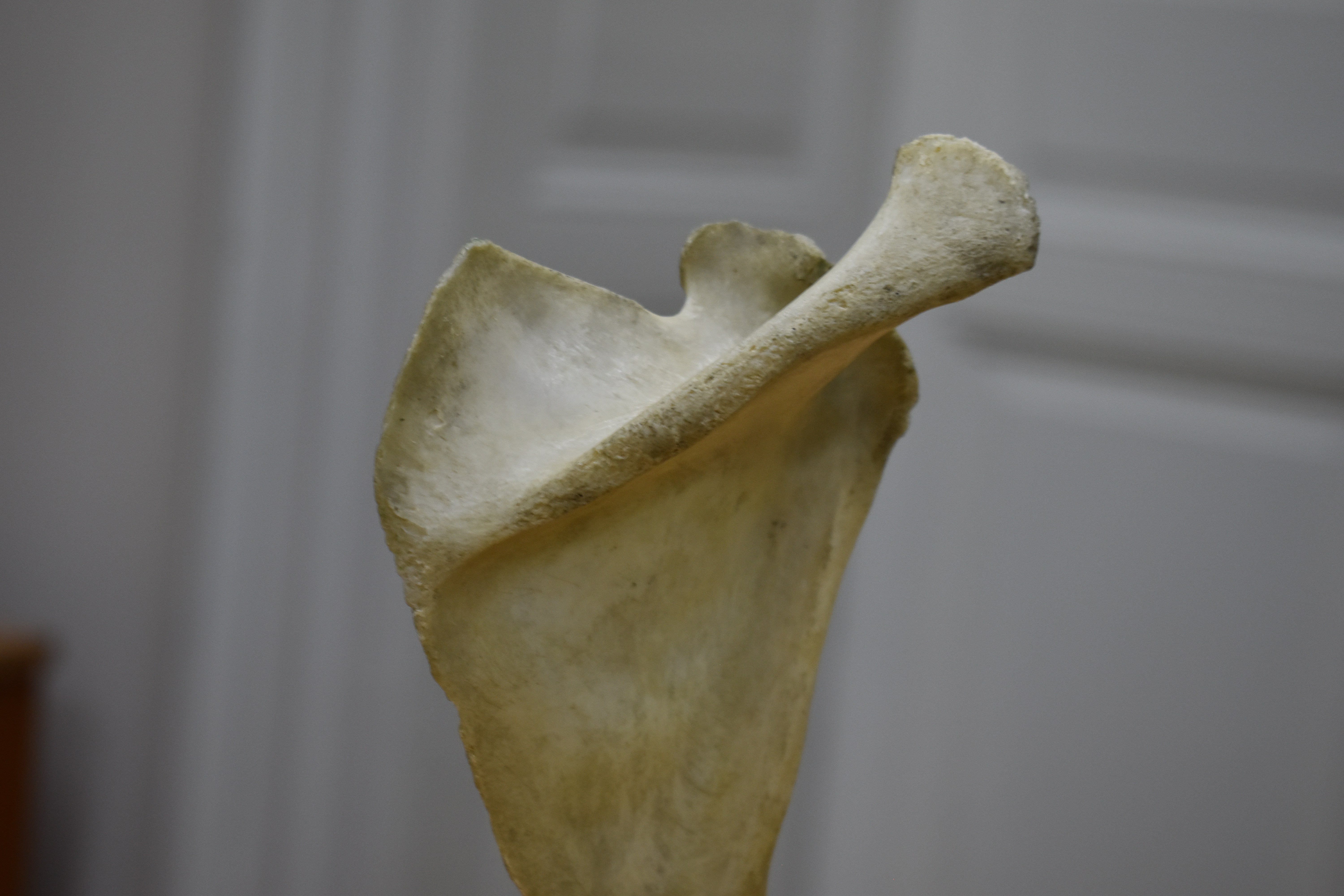 Shoulder Blade Scan - Scapula (R) - Missing Coracoid process — miniatura 3