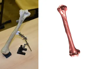 Forearm Bone Scan - Ulna by KubiV | Download free STL model ...