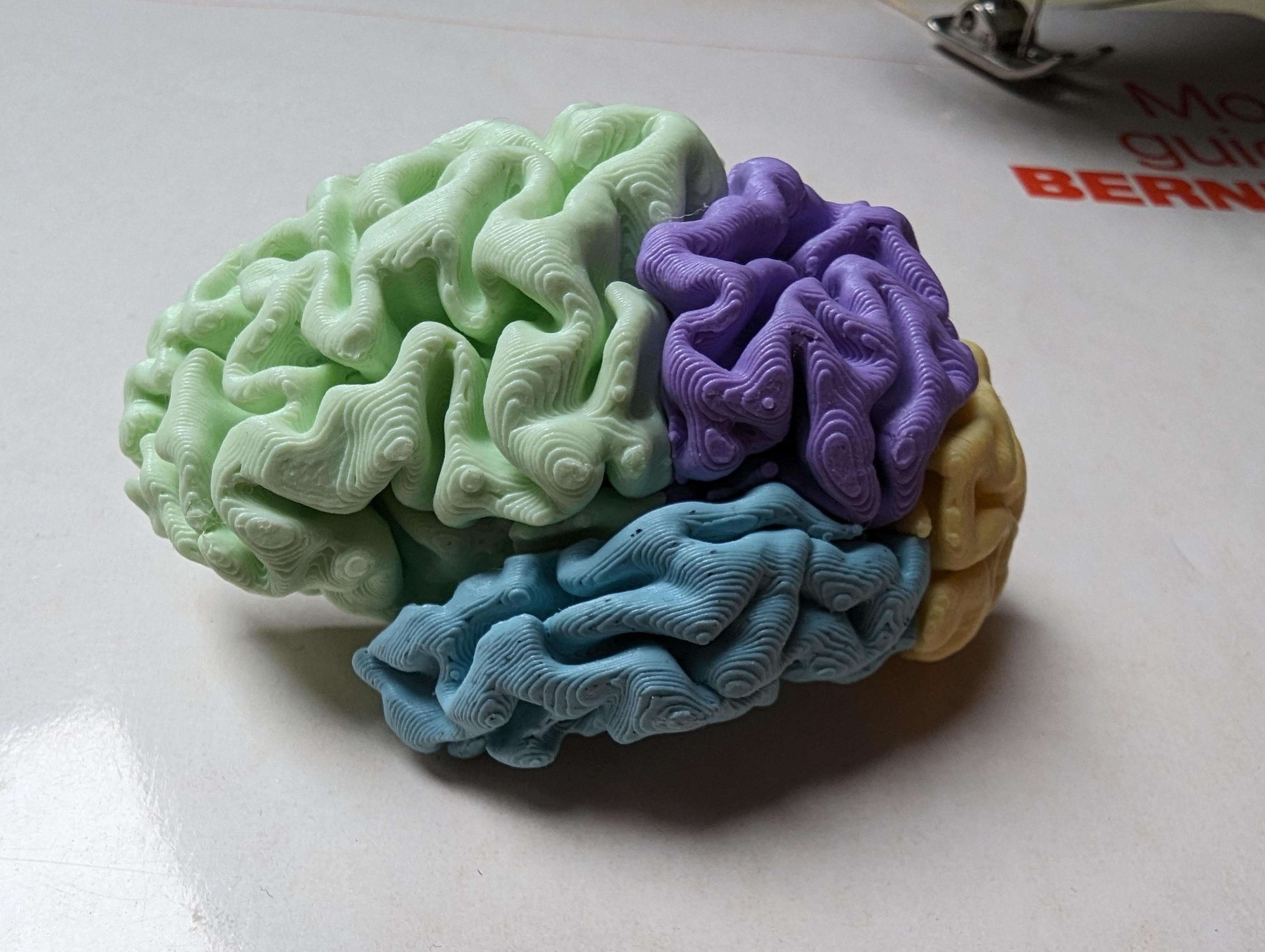 Brain in Parts by wetWool | Download free STL model | Printables.com