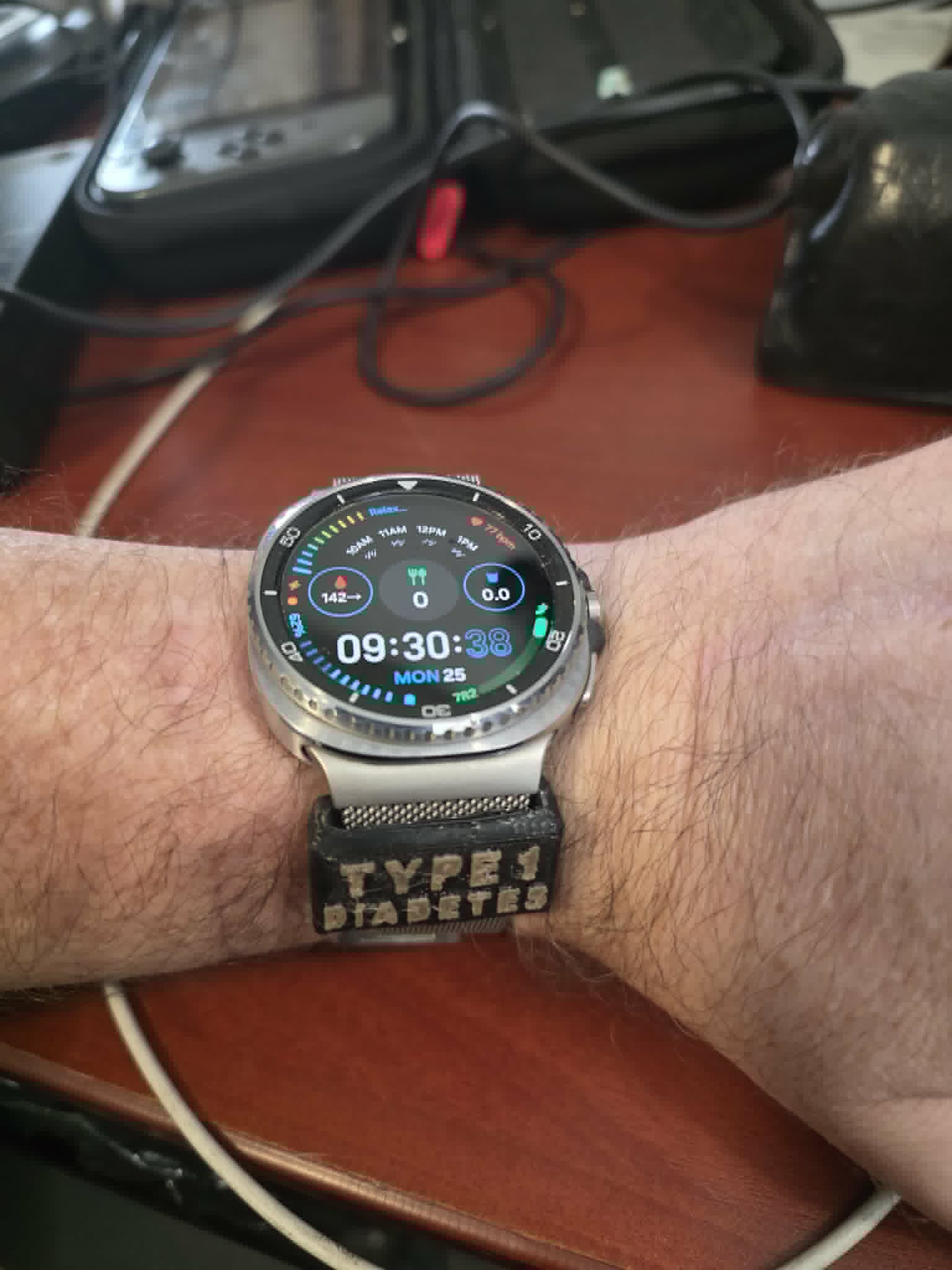 type 1 diabetes watch band