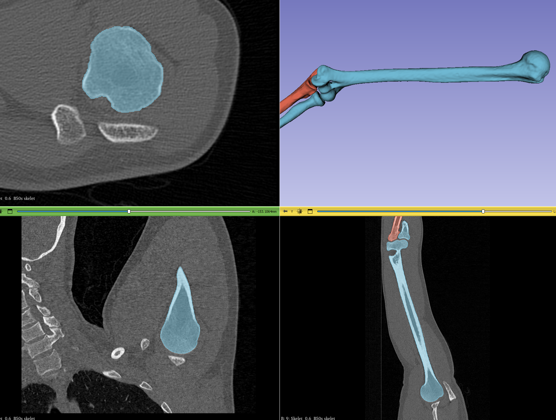 humerus-left-by-karel-p-ni-ka-download-free-stl-model-printables