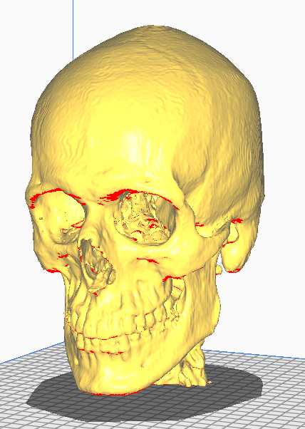 Human skull CT scan