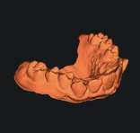My Teeth, if you want them for some reason.