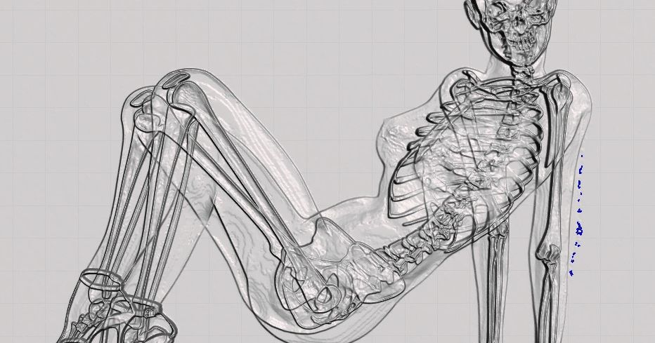 Radiography by LaurentG | Download free STL model | Printables.com
