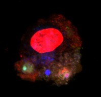 Immature Dendritic Cell