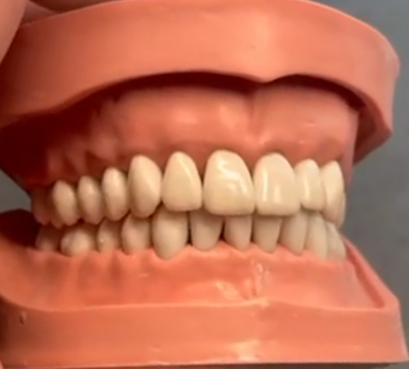 realistic human denture model